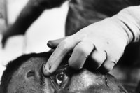 Eye donor at the morgue, Cape Town, South Africa - © Viviane Moos
